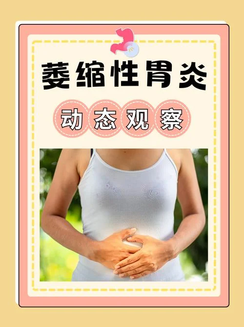 什么是慢性萎缩胃炎_1
