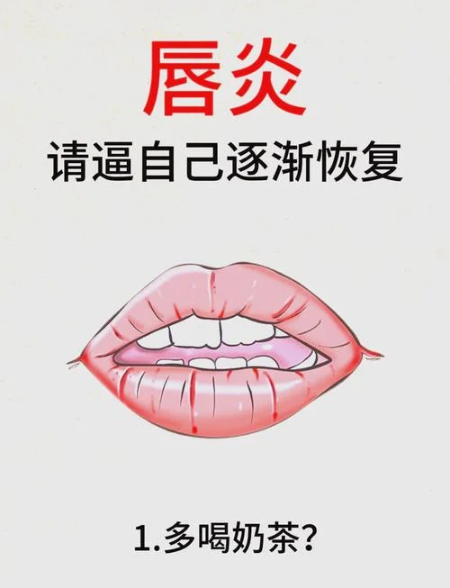 嘴巴开裂怎么办-嘴巴开裂的护理