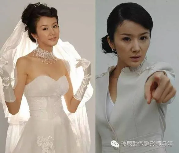 微整形的历史发展史_1