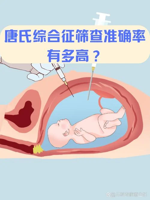 孕妇唐筛是检查什么_1