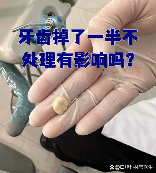 梦到大牙掉了碎成两半-