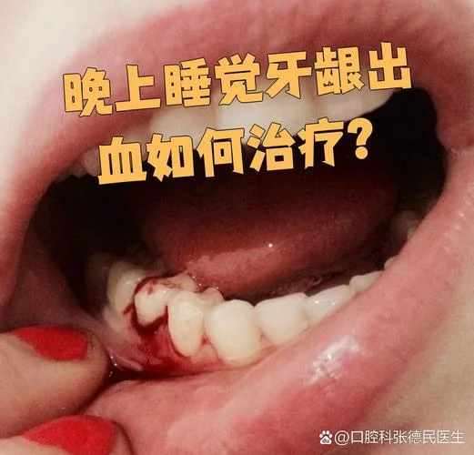 做梦梦到牙齿松动流血_2