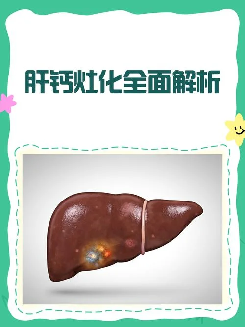 扫及肝右叶钙化灶是什么意思_1