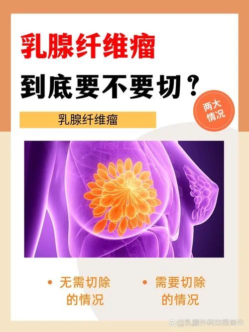 什么是乳腺腺瘤_1