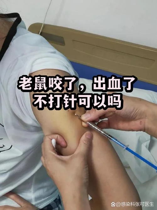 做梦被老鼠咬了是什么意思_1