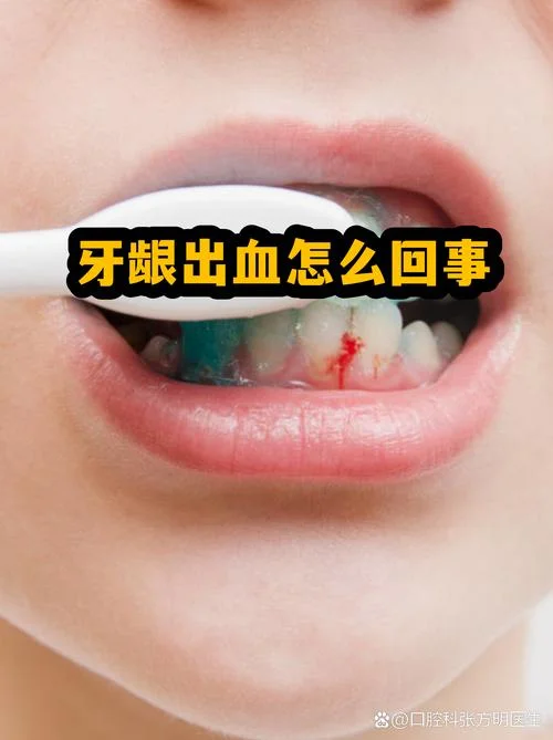 梦见刷牙出血特别严重-梦刷牙大出血