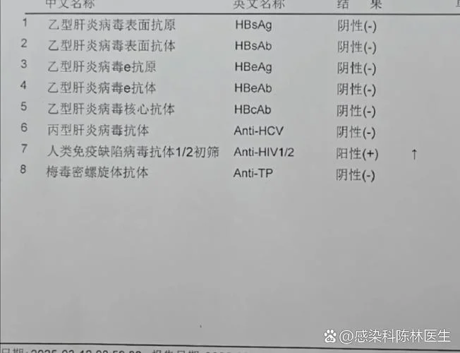 如何查有没有艾滋病_1