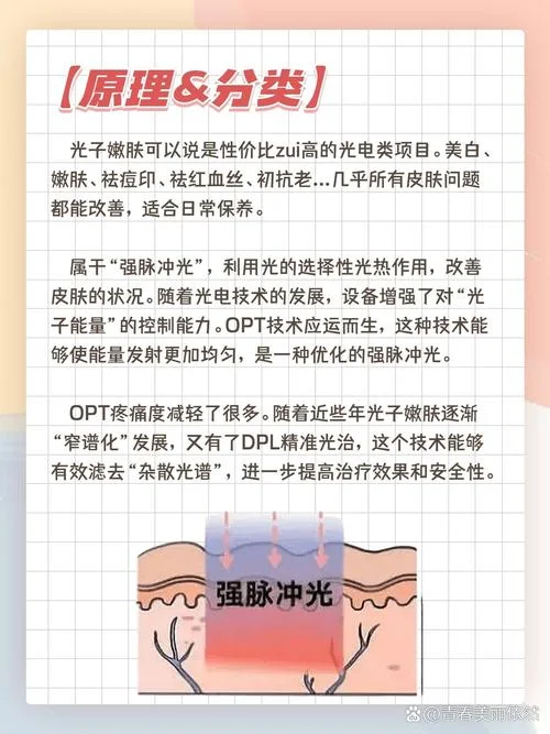 光子嫩肤技术原理_1
