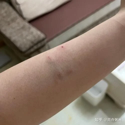孕妇做梦梦到被猫咬手-孕猫咬手梦