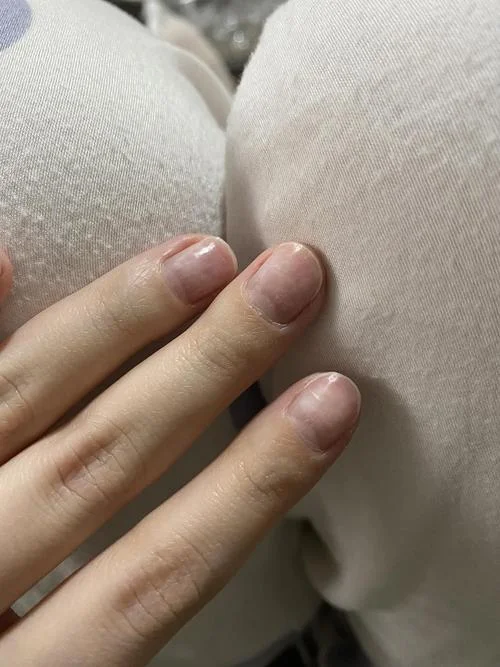 梦见指甲钳坏了_1