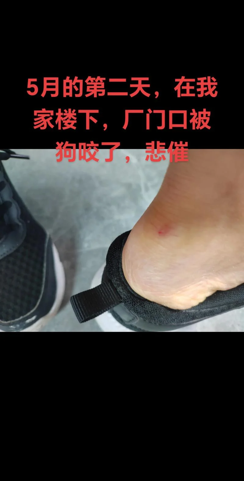 做梦梦到被大黄狗咬_2