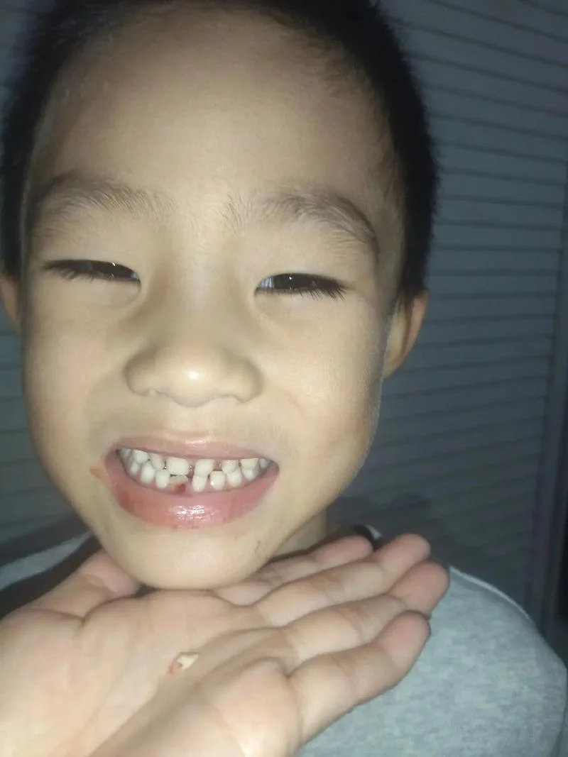 梦见两颗门牙掉了_2
