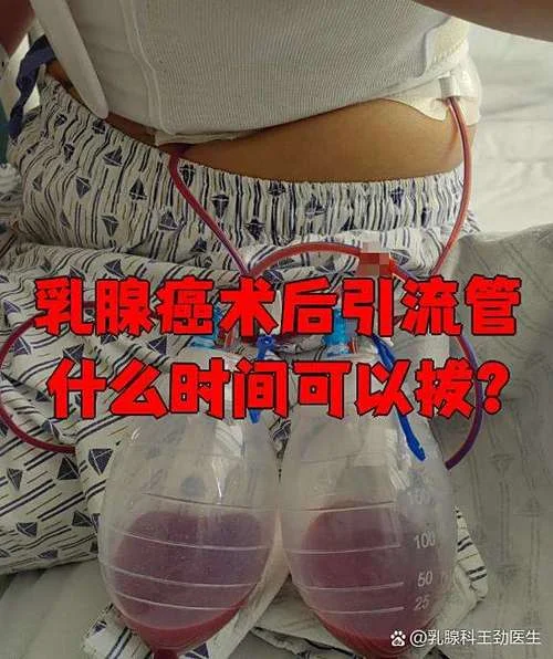 乳腺术后引流管叫什么_1