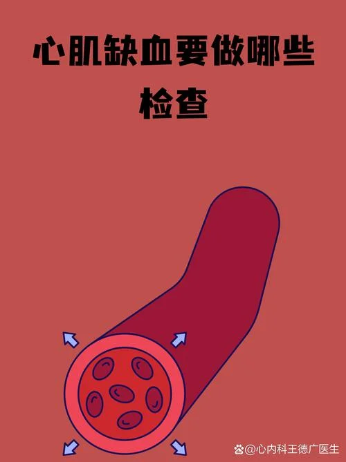 如何查心脏供血不足_1