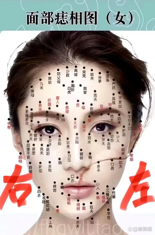 脸颊旁边的痣叫什么痣_2