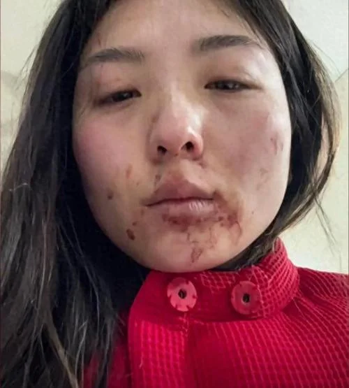 梦见被对象家暴_1