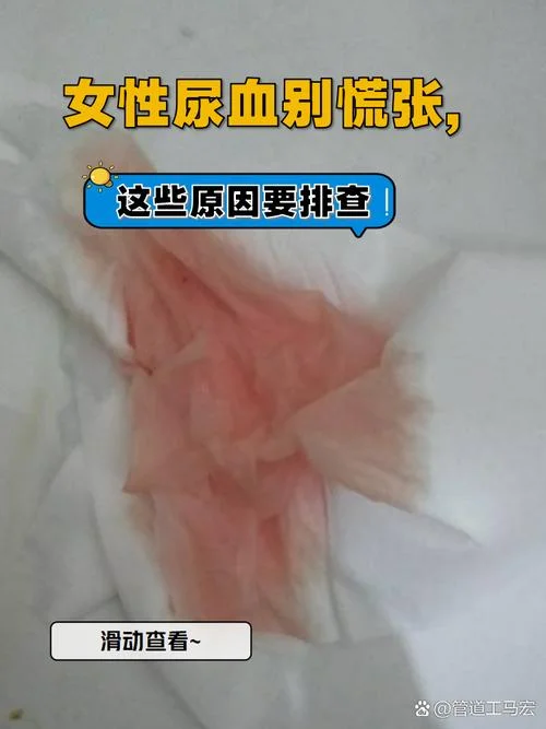 梦见自己小便尿血是什么预兆-梦见尿血预示健康需关注