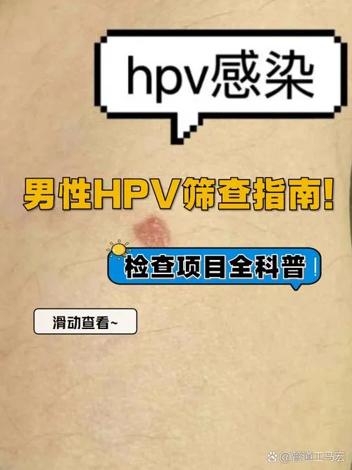男性如何查hpv病毒吗_1