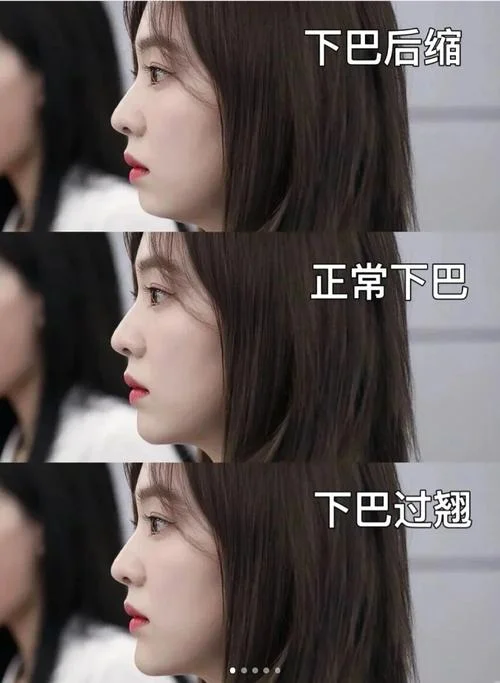 下巴尖小的女人面相-尖下巴小脸女