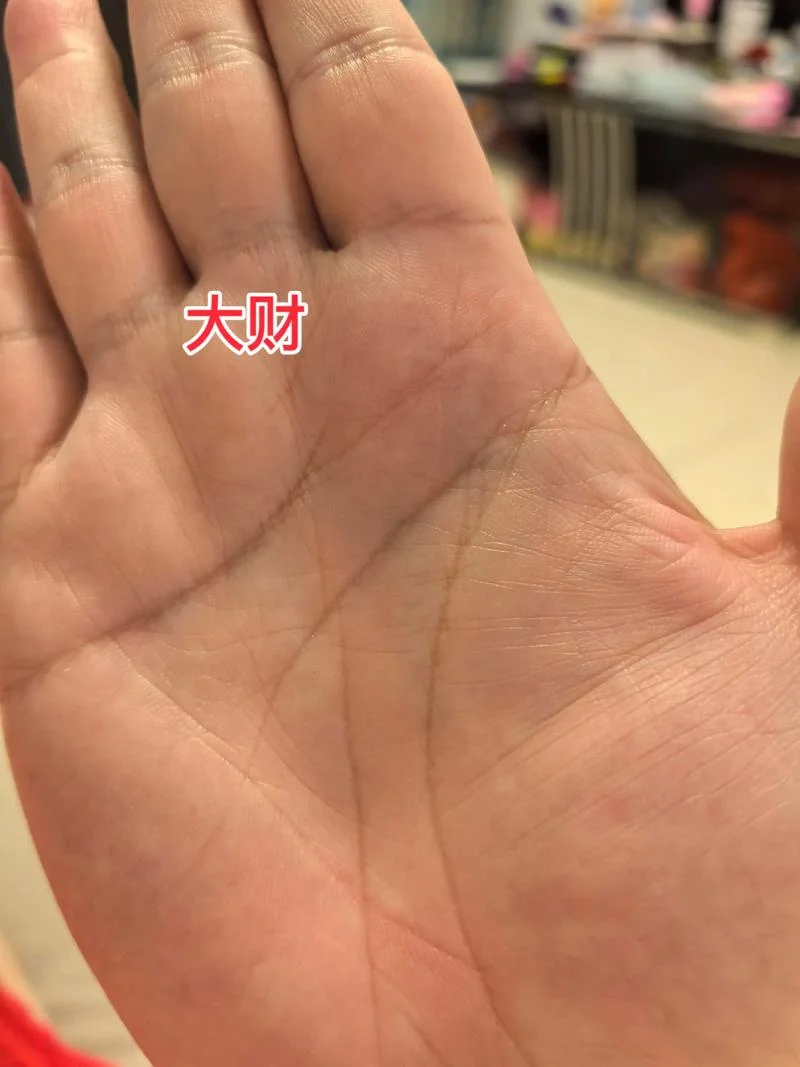 手相大富大贵痣-手相大富大贵痣
