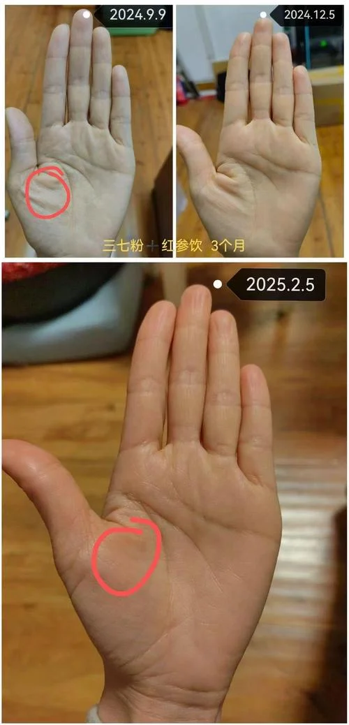 三宫饱满手相-三宫饱满手相
