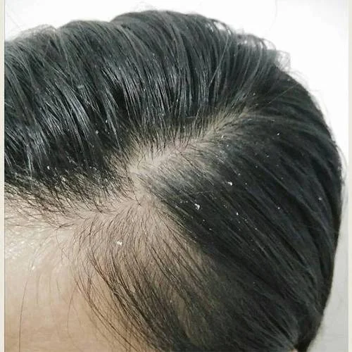 全世界十大品牌洗发水_1