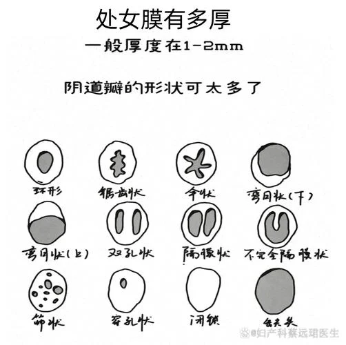 怎么看出处女膜_1