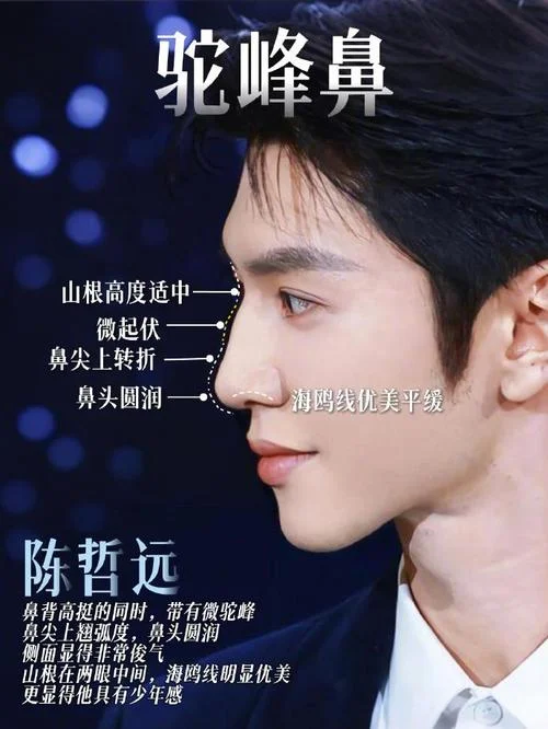 什么是驼峰鼻_2
