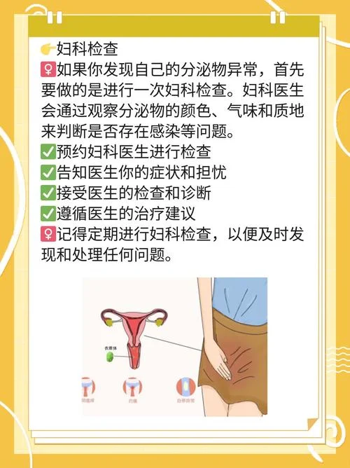 检查分泌物是检查什么_1