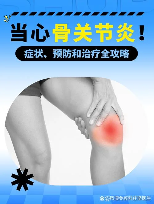 骨性关节炎又叫什么_1