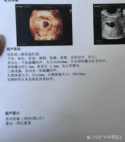 未见胚芽结构什么意思_2