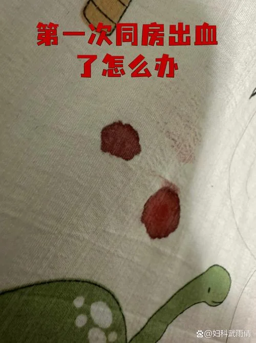 两次见红是为什么_1