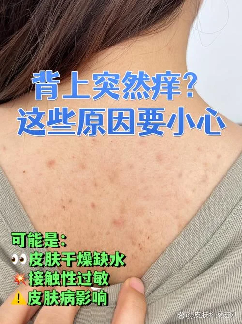 后背皮肤瘙痒怎么办_1