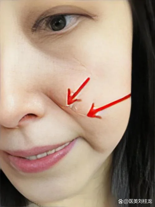 有法令纹的面相女_1