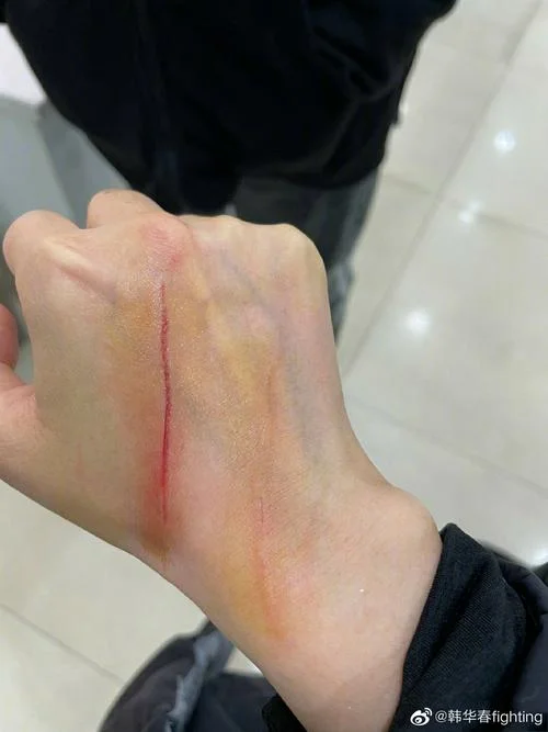梦见手被猫抓破了流血_1