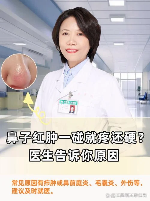 隆鼻后鼻孔发淡怎么办_2