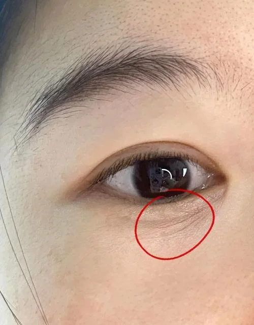 眼下细纹面相图解女-细纹面相女图解