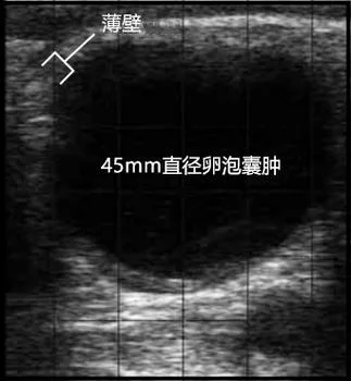 b超如何查卵泡-卵泡检测超临界