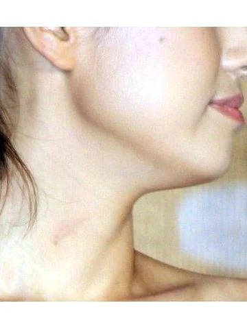 梦见吻痕-吻痕美梦现