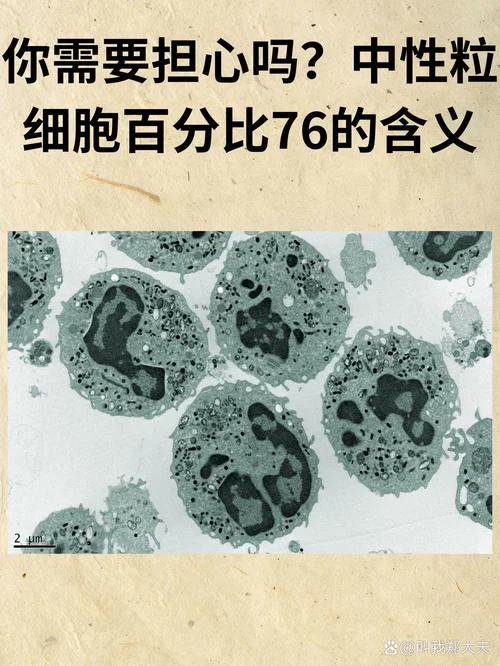 什么是中性学说_1