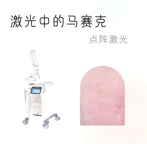 点阵激光原理去凹坑_2