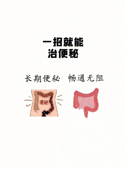 便秘的怎么办-便秘怎么办？