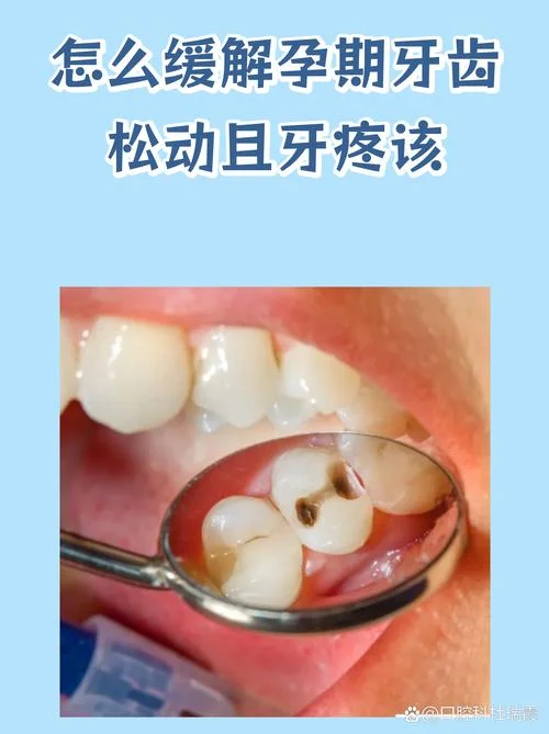 怀孕梦见牙齿松动没掉_1