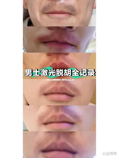 梦见刮胡子刮了一半_1