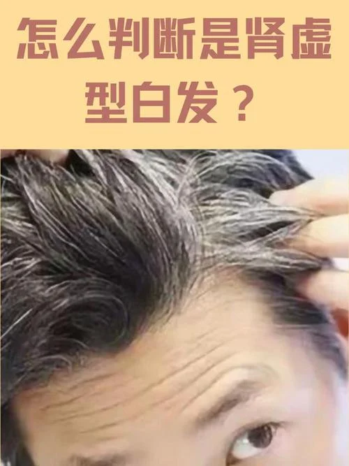 梦到自己头顶头发白了_1