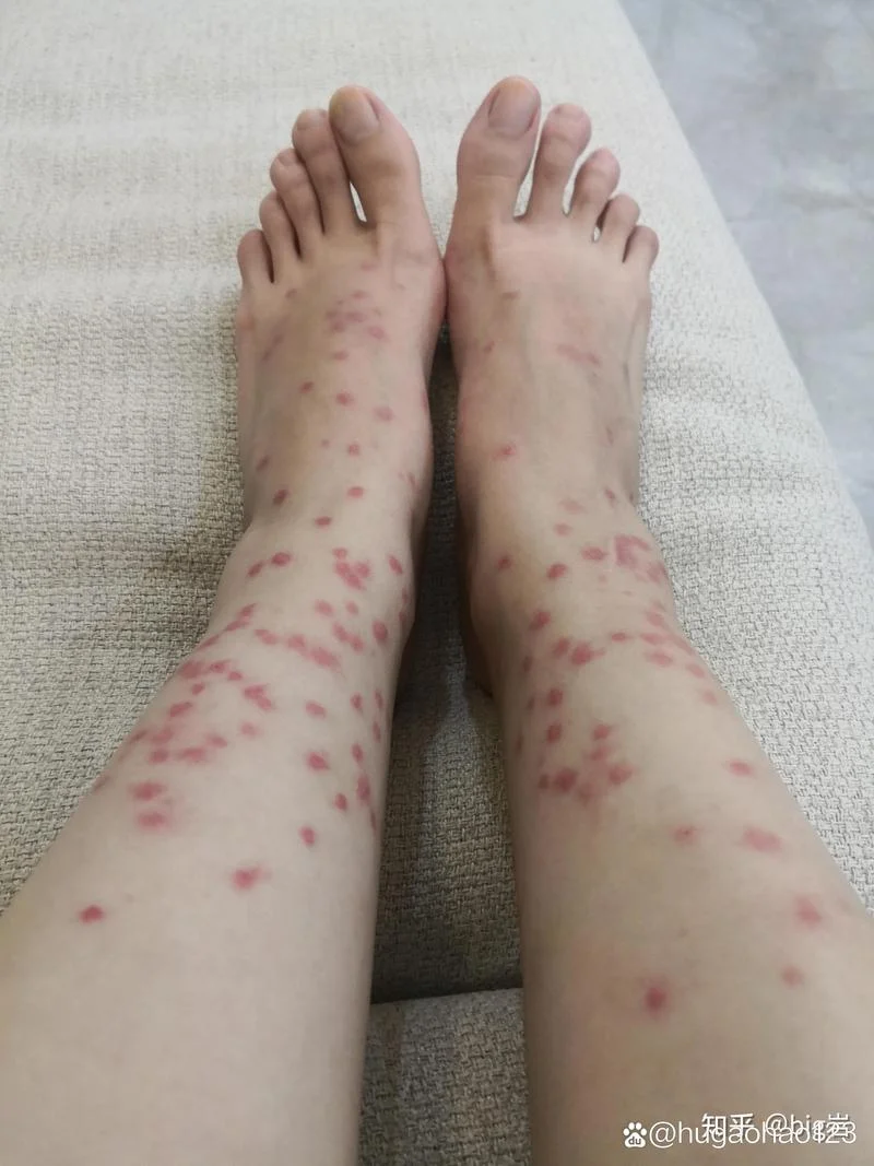 梦见好多小虫子追我_2