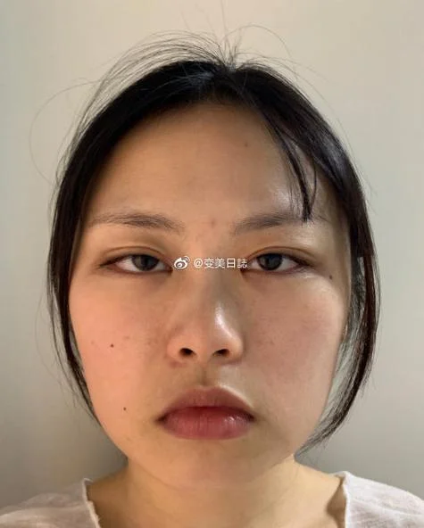垫下巴多少钱一平方_1
