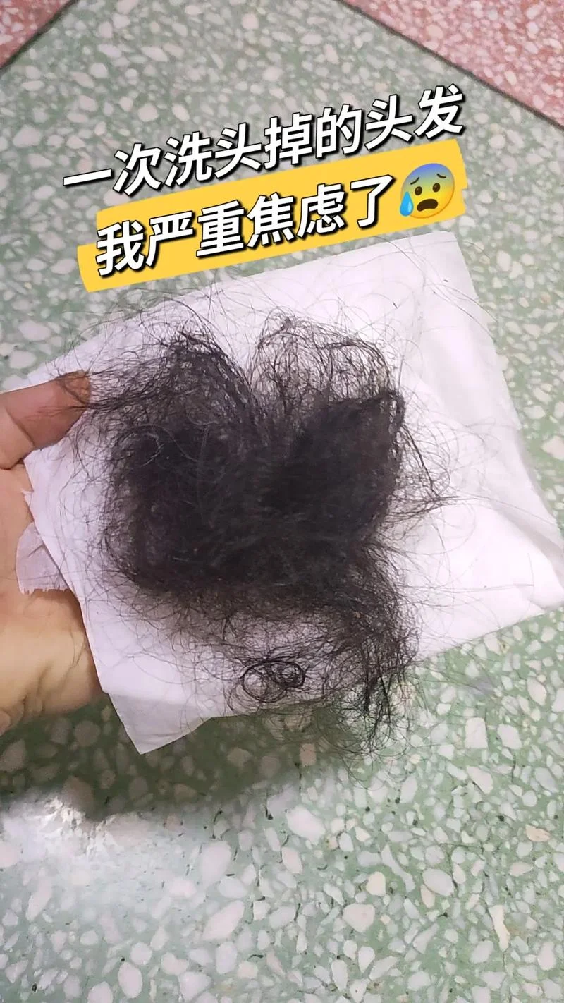 梦见洗头掉了撮头发_1