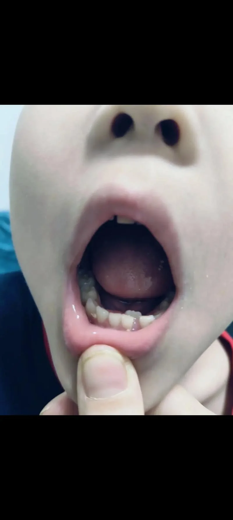 梦见牙齿长长了_2