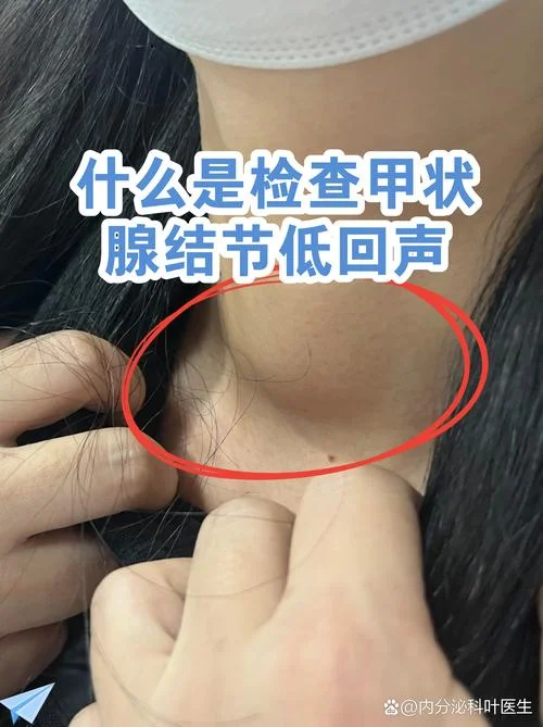 什么是片状低回声_1